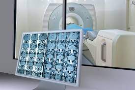 Prostat Kanserinde Genetik Değişiklikler ve Tedaviye Yansımaları