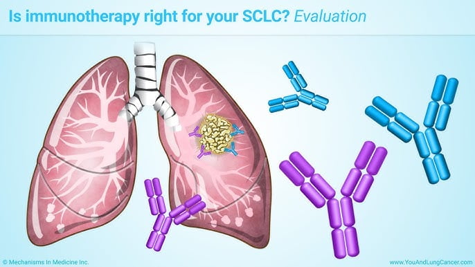Küçük Hücreli Akciğer Kanserinde Yeni tedavi seçeneği olarak Durvalumab