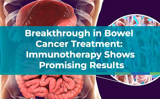 colon cancer