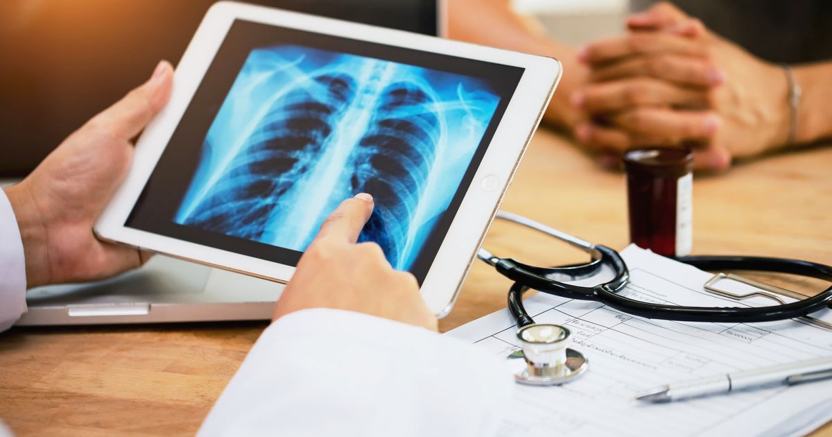 lung cancer