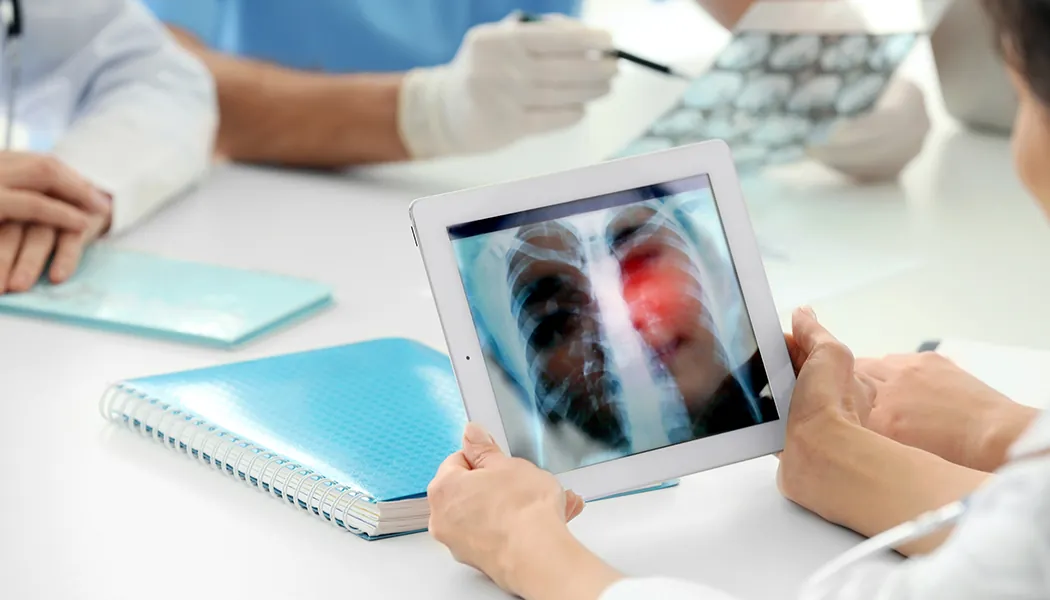 lung cancer foto