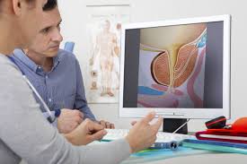 prostat cancer new photo