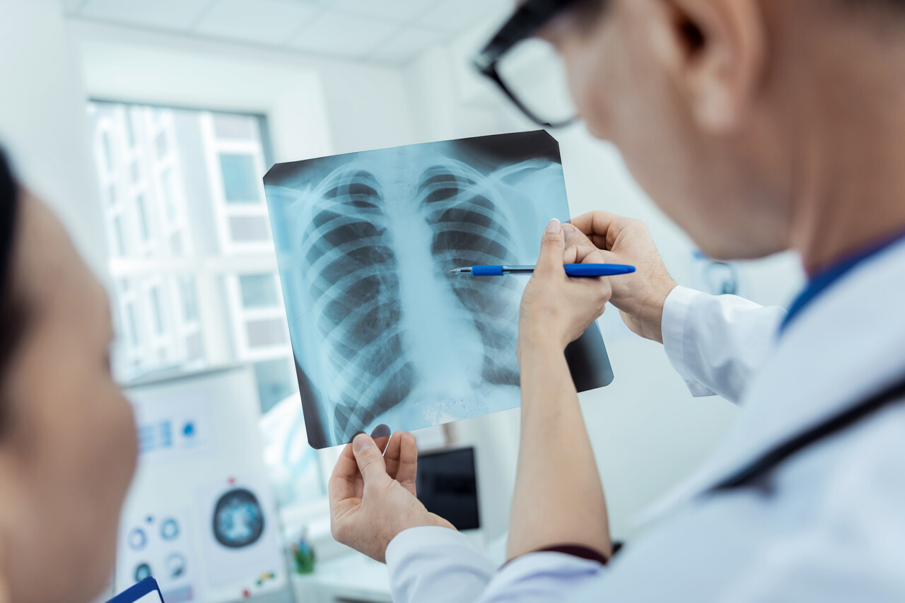 Akciğer kanserinde yeni tedavi seçeneği olarak Ivonescimab